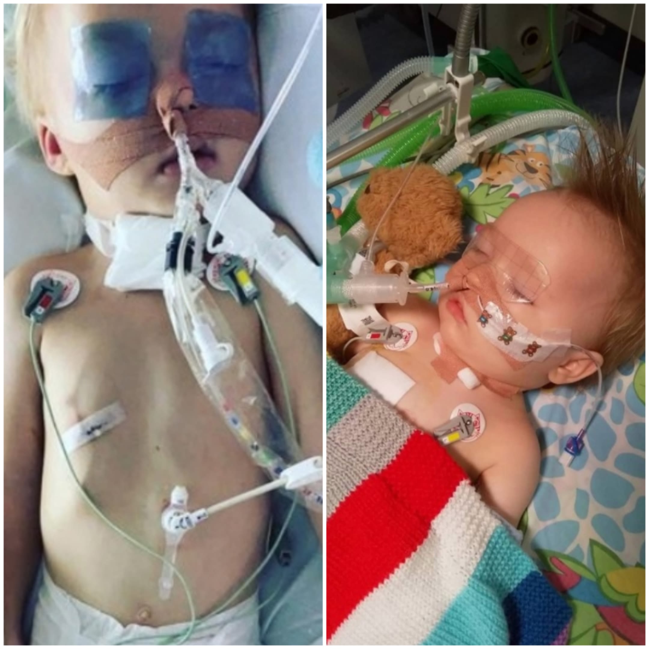 Two separate photos of baby boys in intensive care. The boy on the left has his eyes closed and many tubes in his nose, neck, tummy button and on his chest. The other baby has tubes in his nose, neck and on his chest. He has a brown teddy next to him and a colourful blanket over him.